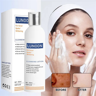 Whitening Facial Cleanser Effective Remove Melasma Dark Spots